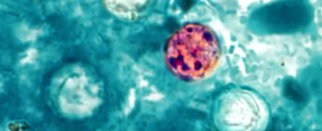La ‘cyclospora’ se dispara en Estados Unidos: qué es esta enfermedad parasitaria que provoca diarrea ‘explosiva’