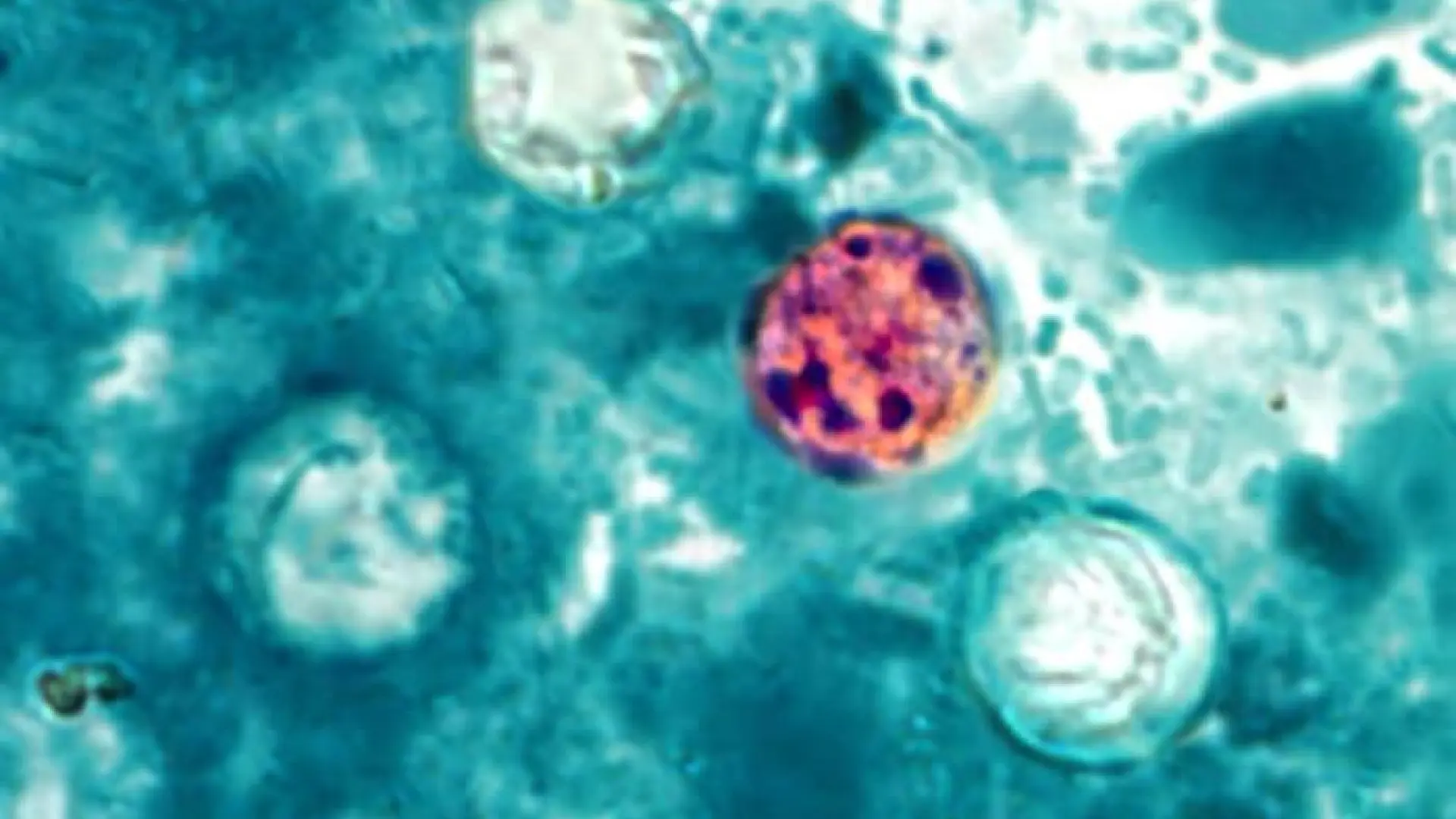 La ‘cyclospora’ se dispara en Estados Unidos: qué es esta enfermedad parasitaria que provoca diarrea ‘explosiva’